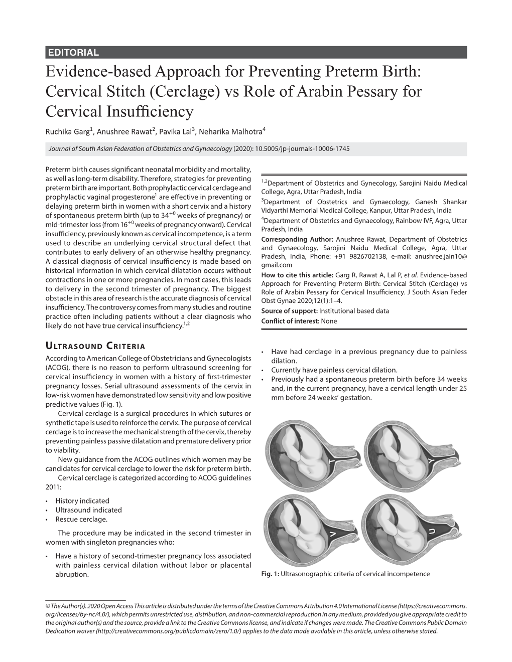 Evidence-Based Approach for Preventing Preterm Birth: Cervical Stitch (Cerclage)