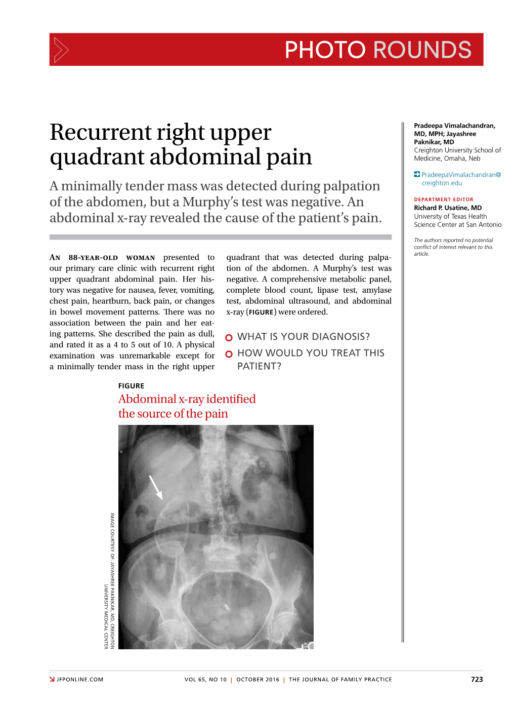 Recurrent Right Upper Quadrant Abdominal Pain