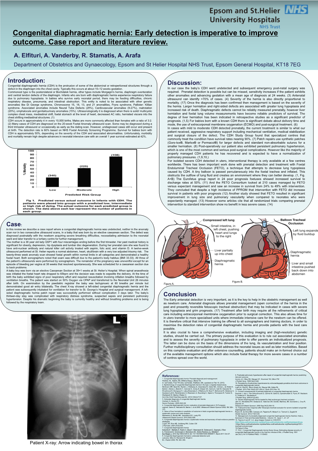 A Case of Congenital Diaphragmatic Hernia