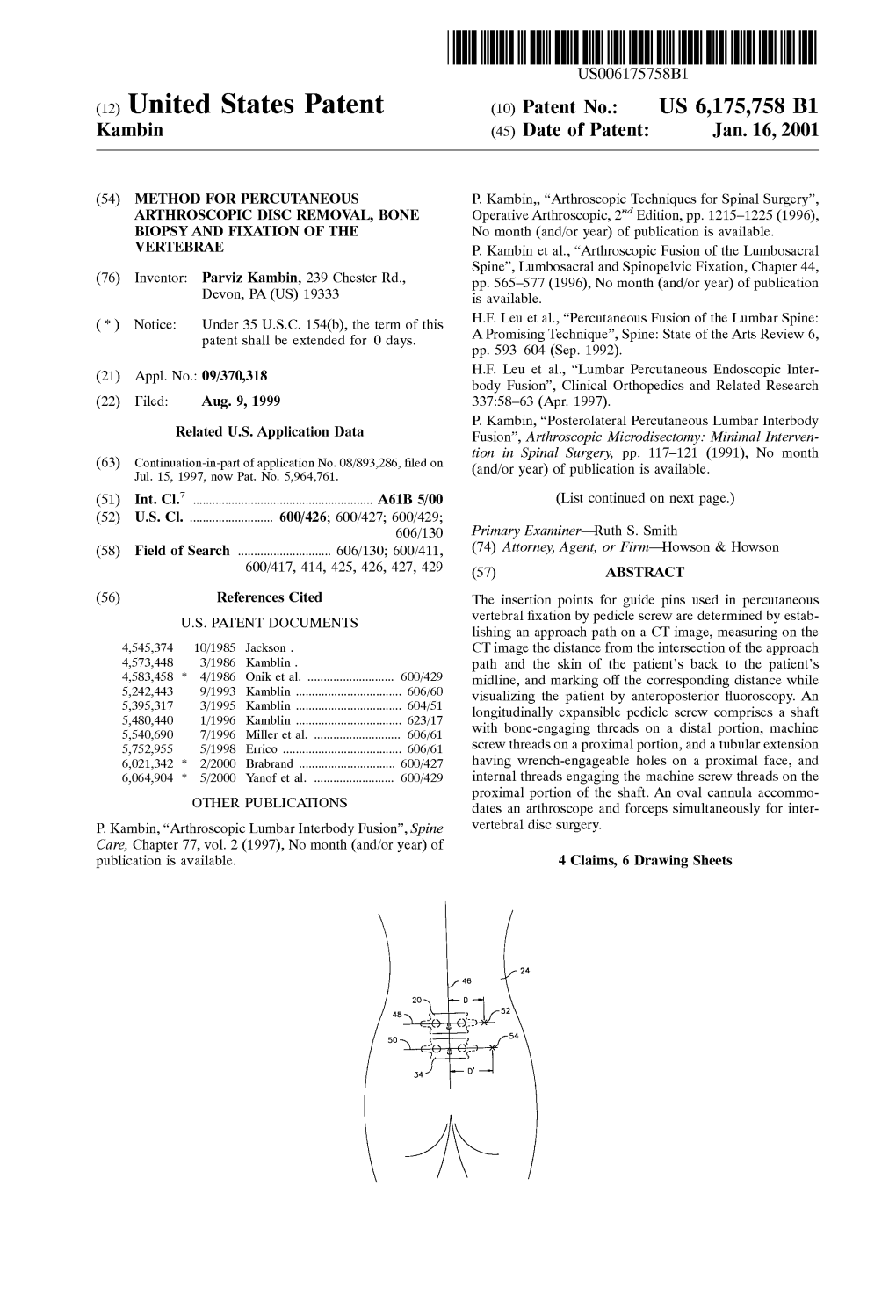 (12) United States Patent (10) Patent No.: US 6,175,758 B1 Kambin (45) Date of Patent: Jan