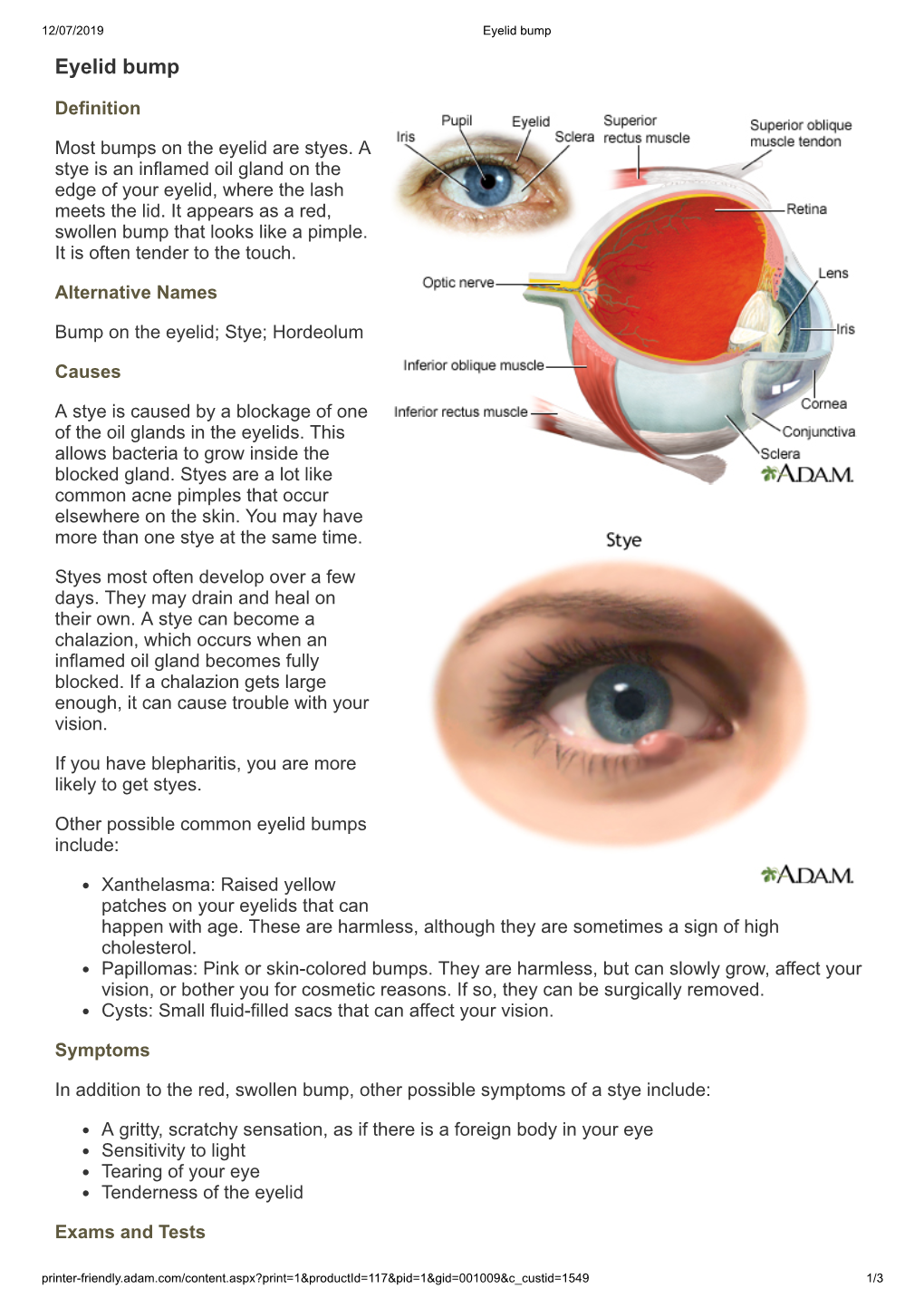 Eyelid Bump Eyelid Bump