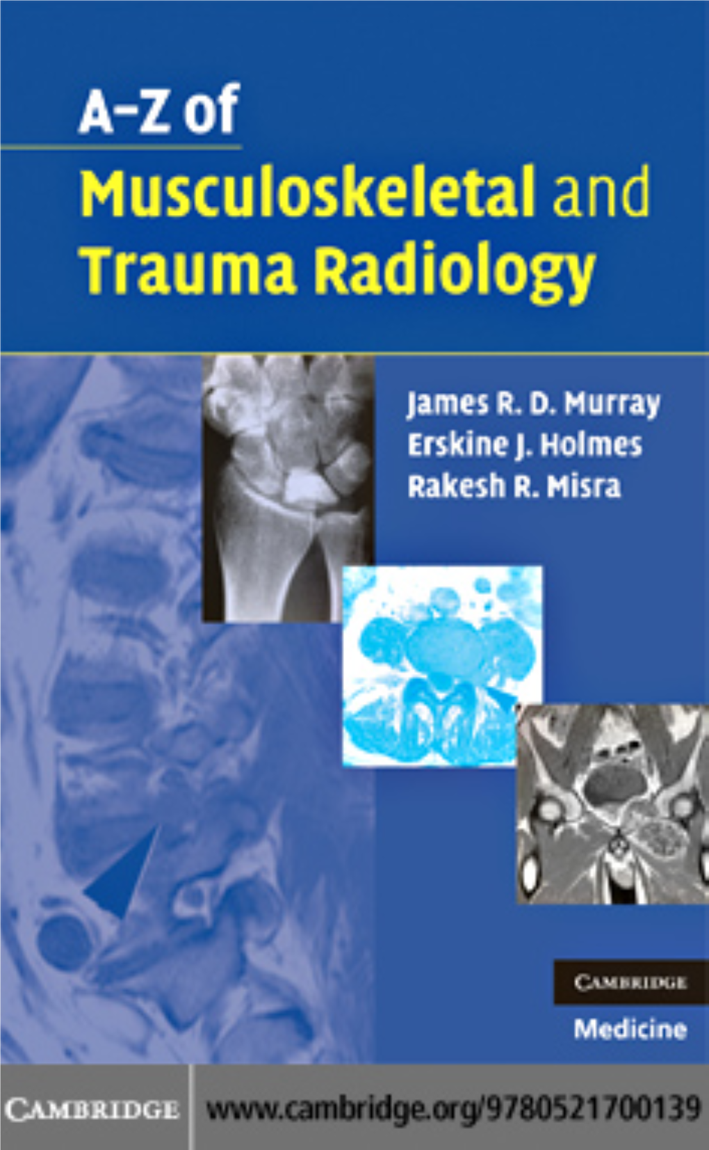 A–Z of Musculoskeletal and Trauma Radiology