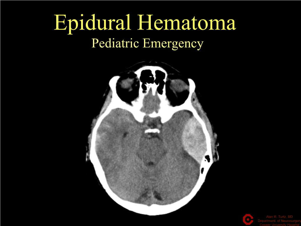 Epidural Hematoma Pediatric Emergency