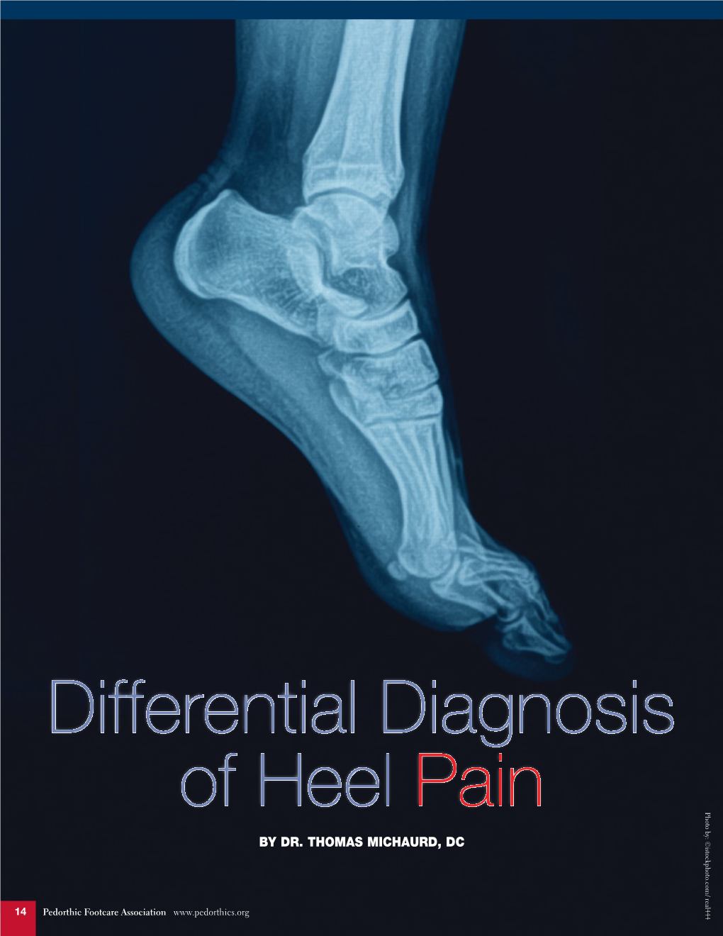 Differential Diagnosis of Heel Pain