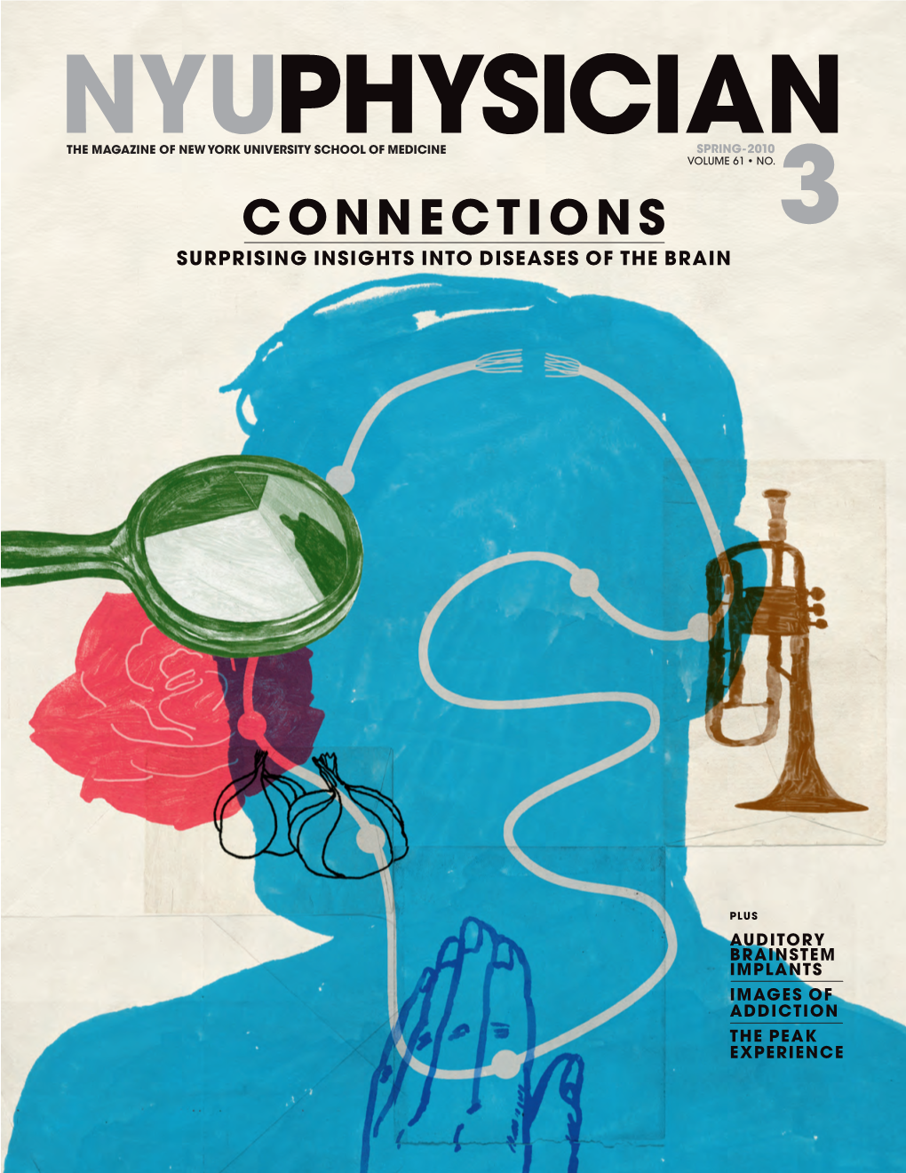Connections 3 Surprising Insights Into Diseases of the Brain