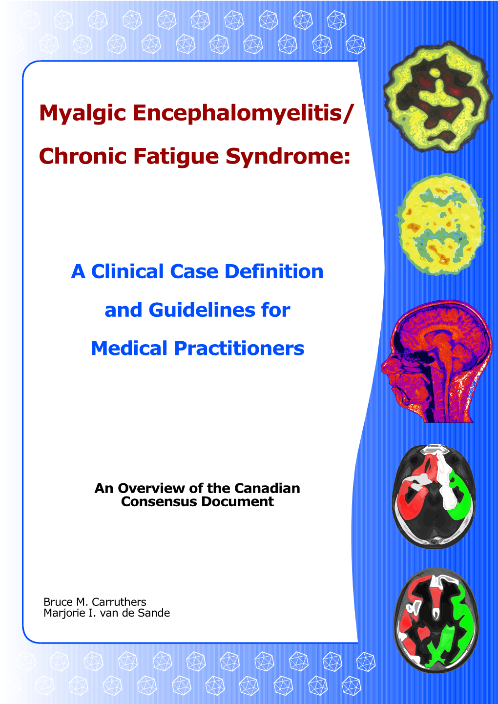 Myalgic Encephalomyelitis/Chronic Fatigue Syndrome