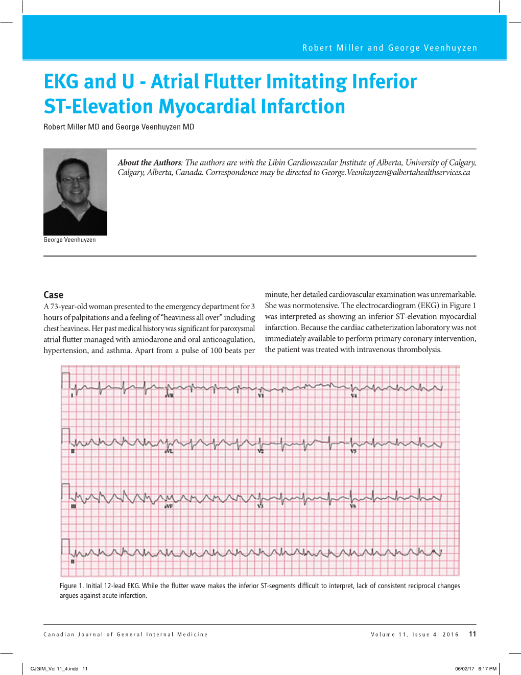 Atrial Flutter Imitating Inferior ST-Elevation Myocardial Infarction Robert Miller MD and George Veenhuyzen MD