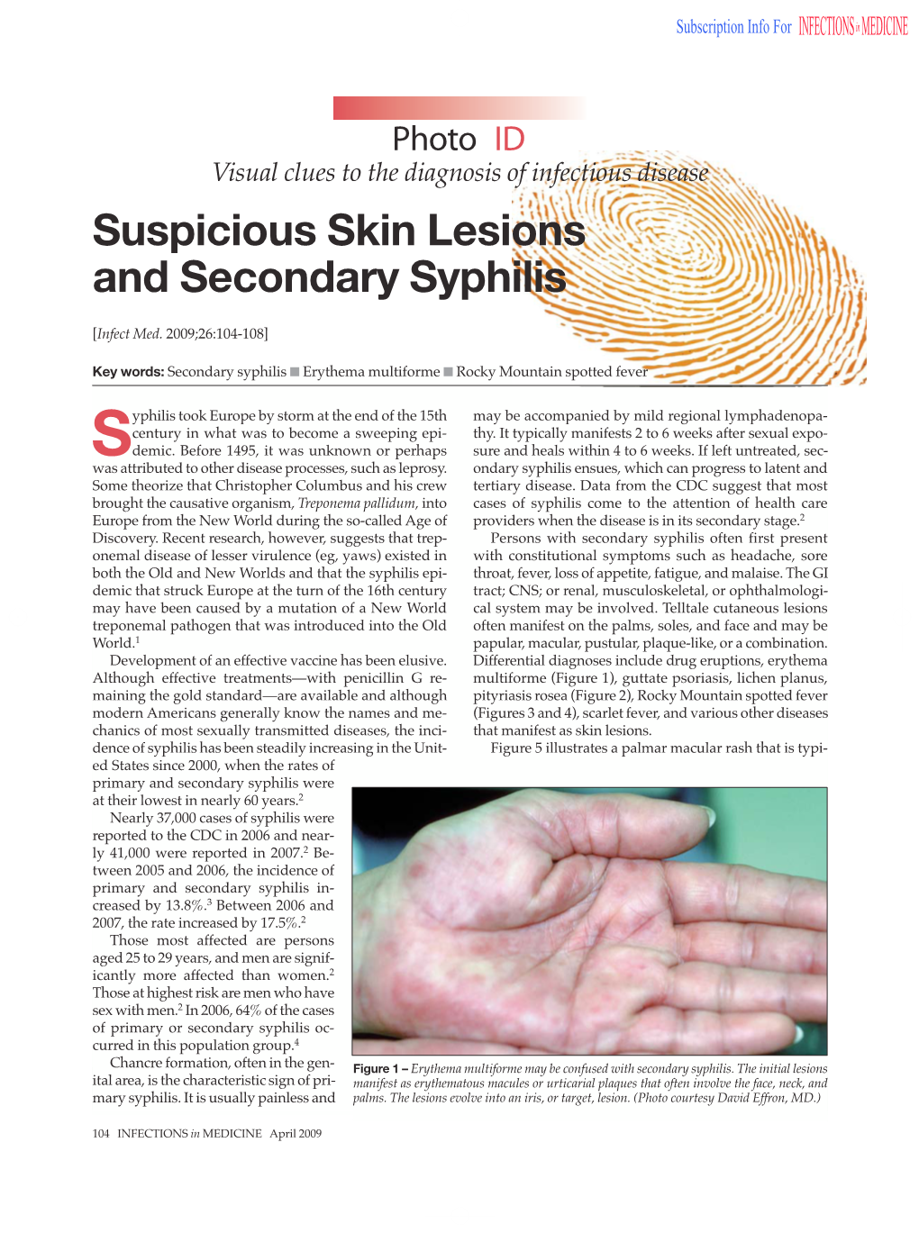 Suspicious Skin Lesions and Secondary Syphilis