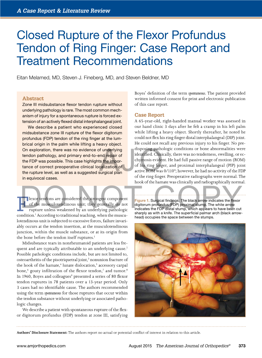 Closed Rupture of the Flexor Profundus Tendon of Ring Finger: Case Report and Treatment Recommendations