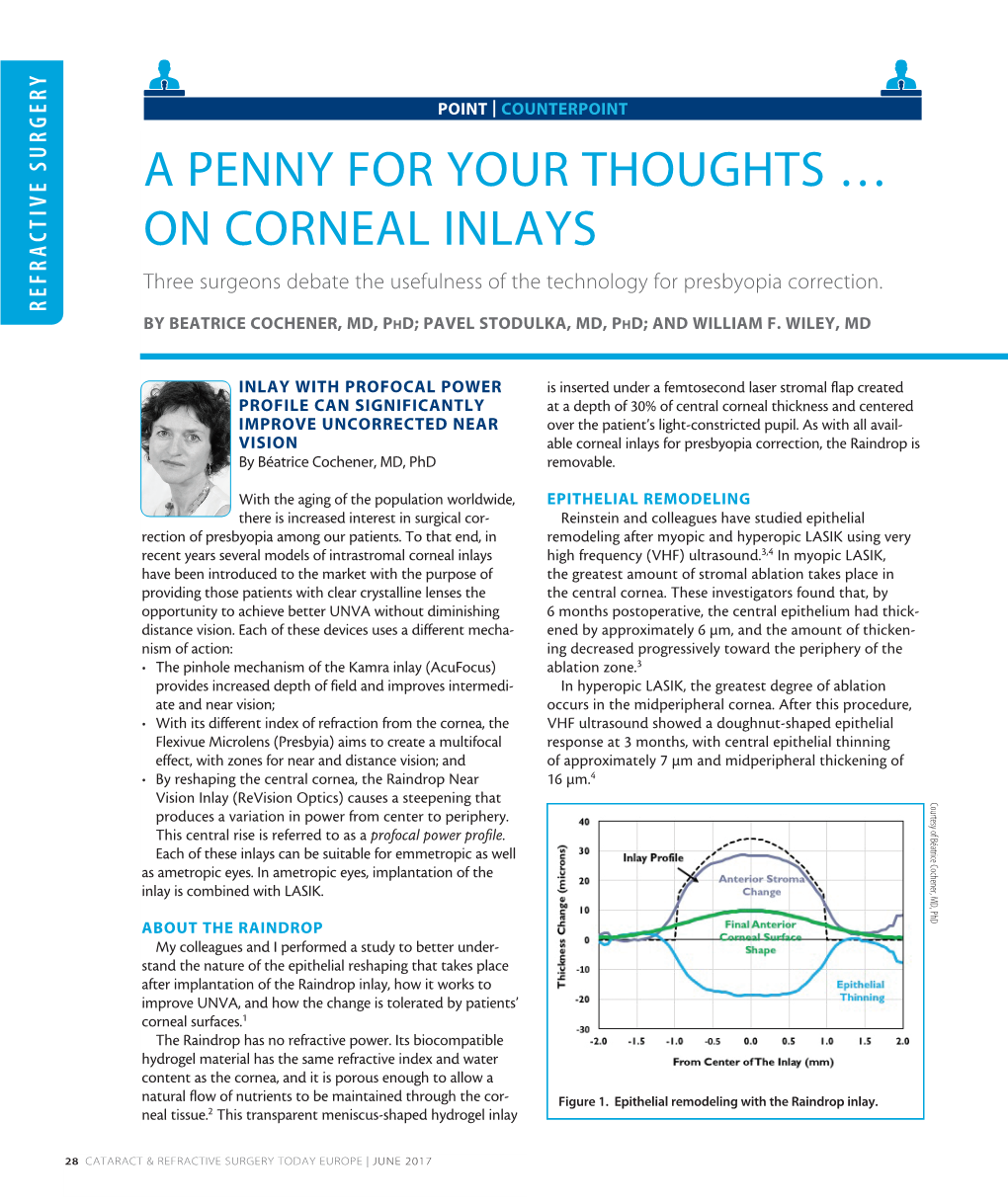 On Corneal Inlays