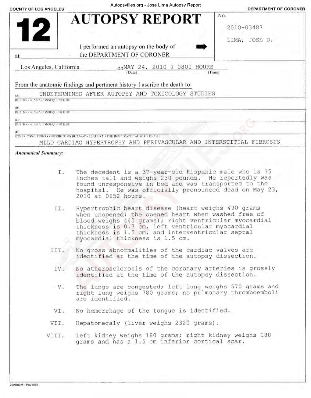 Jose Lima Autopsy Report COL'nty of LOS ANGELES DEPARTMENT of CORONER AUTOPSY REPORT No