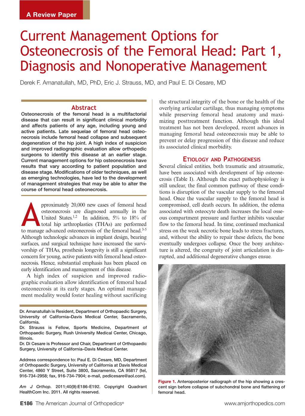 Current Management Options for Osteonecrosis of the Femoral Head: Part 1, Diagnosis and Nonoperative Management Derek F