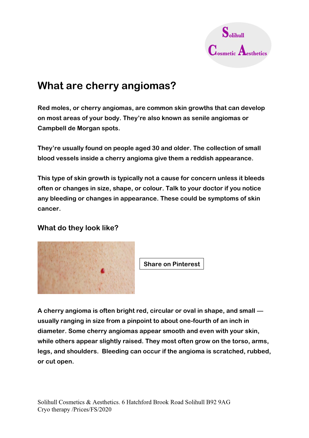What Are Cherry Angiomas?
