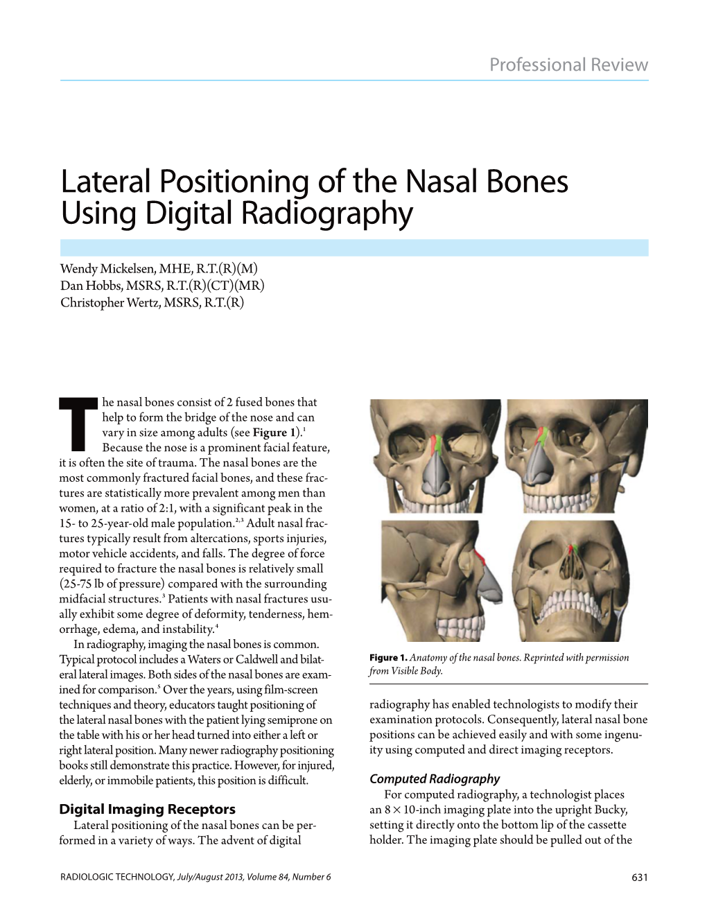 Lateral Positioning of the Nasal Bones Using Digital Radiography