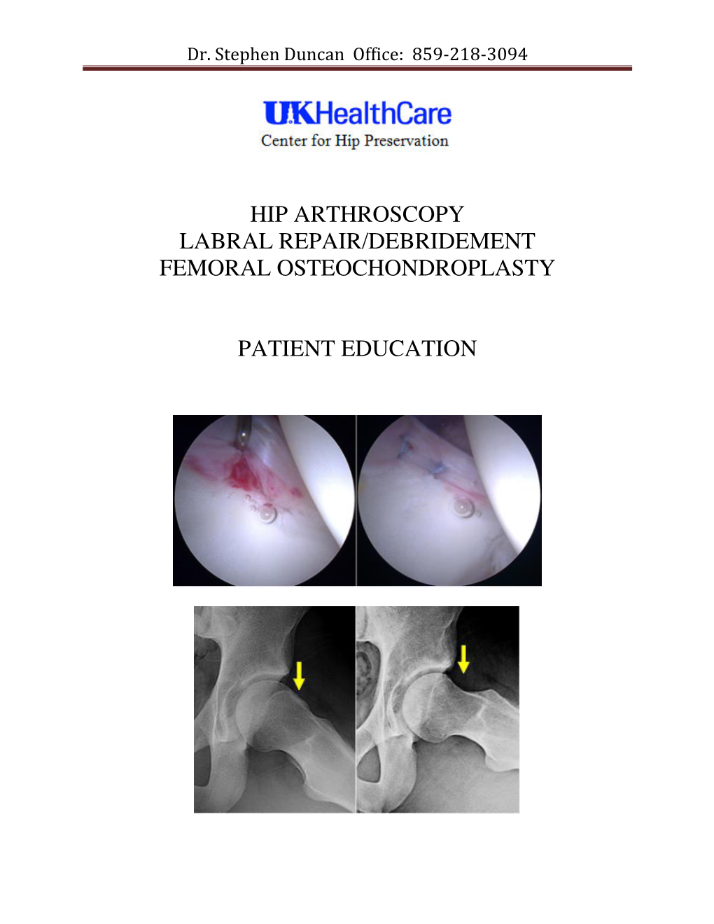 Hip Arthroscopy Labral Repair/Debridement Femoral Osteochondroplasty