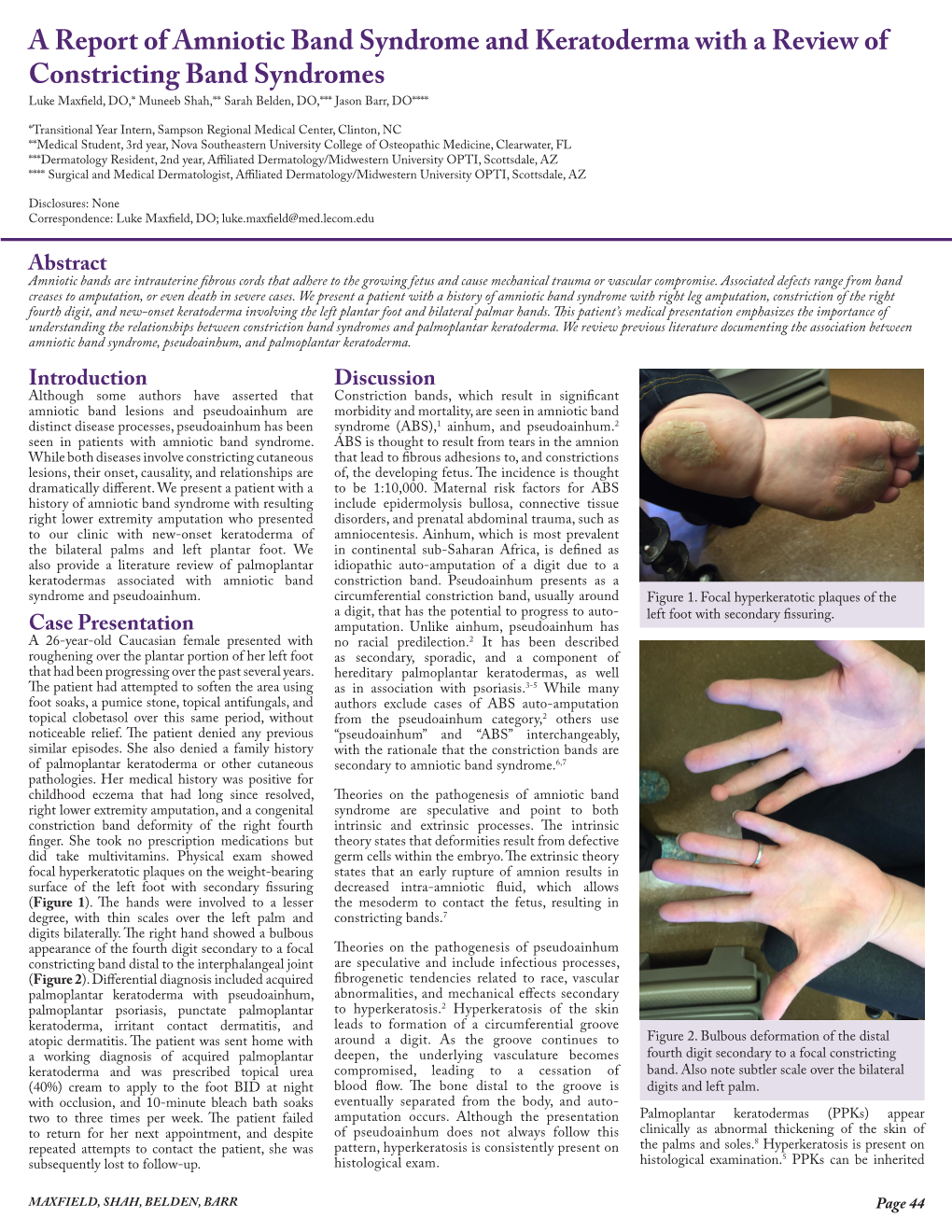 A Report of Amniotic Band Syndrome and Keratoderma with a Review Of