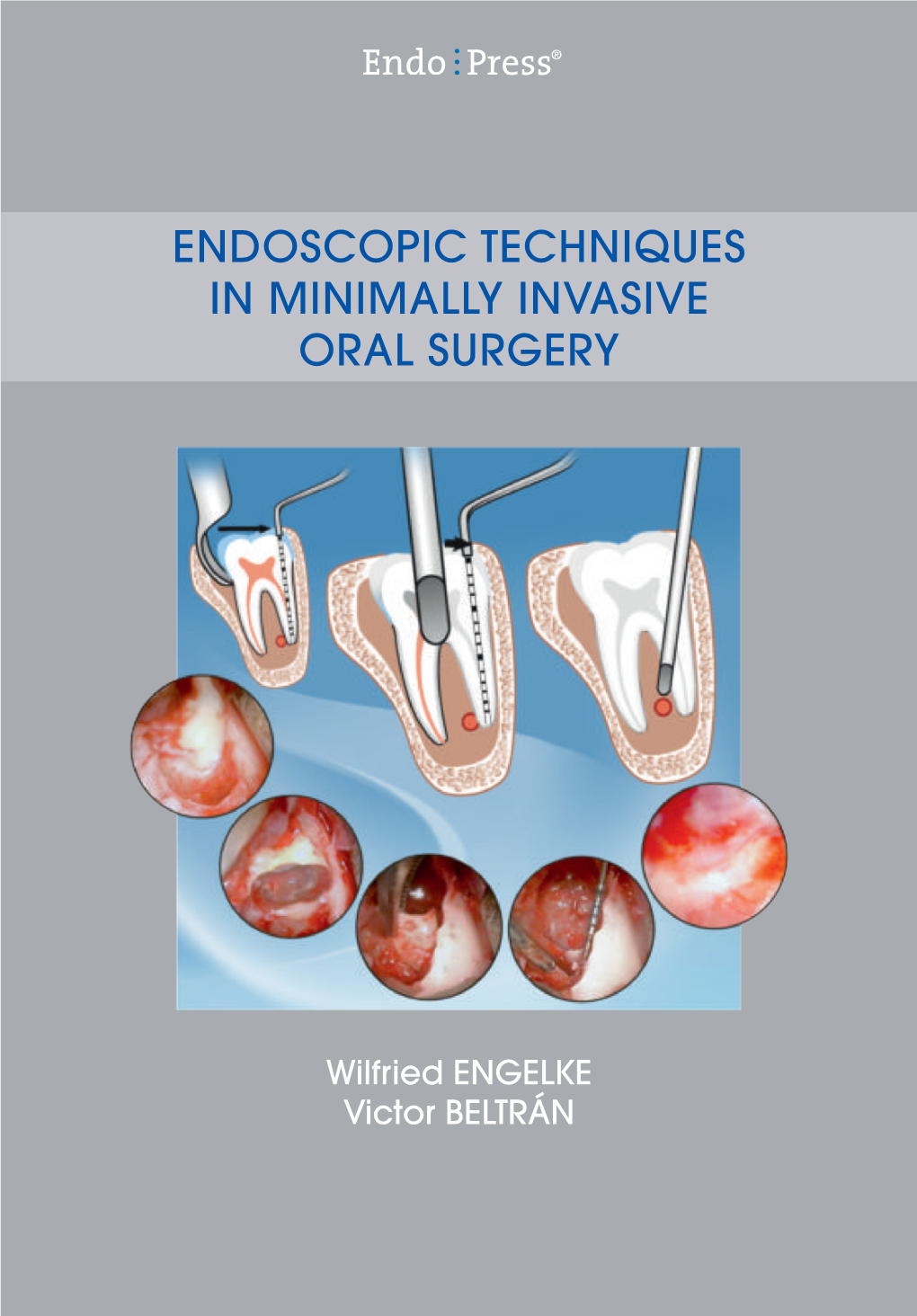 Endoscopic Techniques in Minimally Invasive Oral Surgery