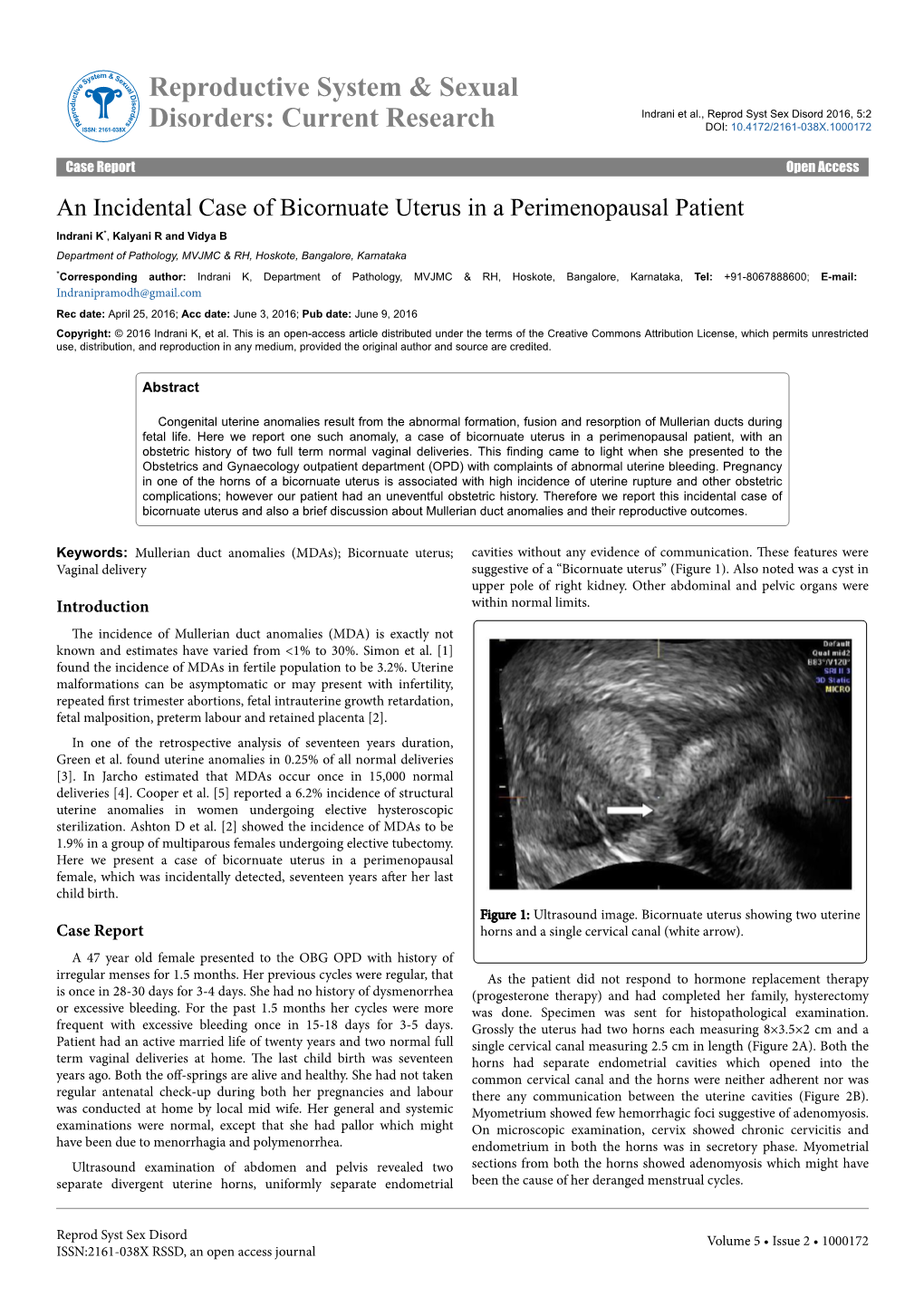 An Incidental Case of Bicornuate Uterus in a Perimenopausal Patient