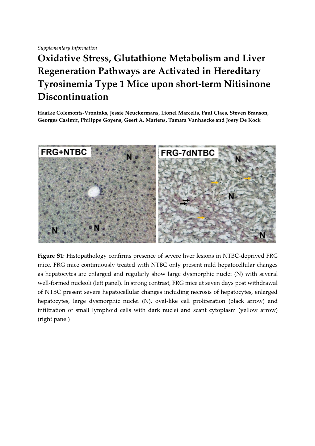 Oxidative Stress, Glutathione Metabolism and Liver Regeneration