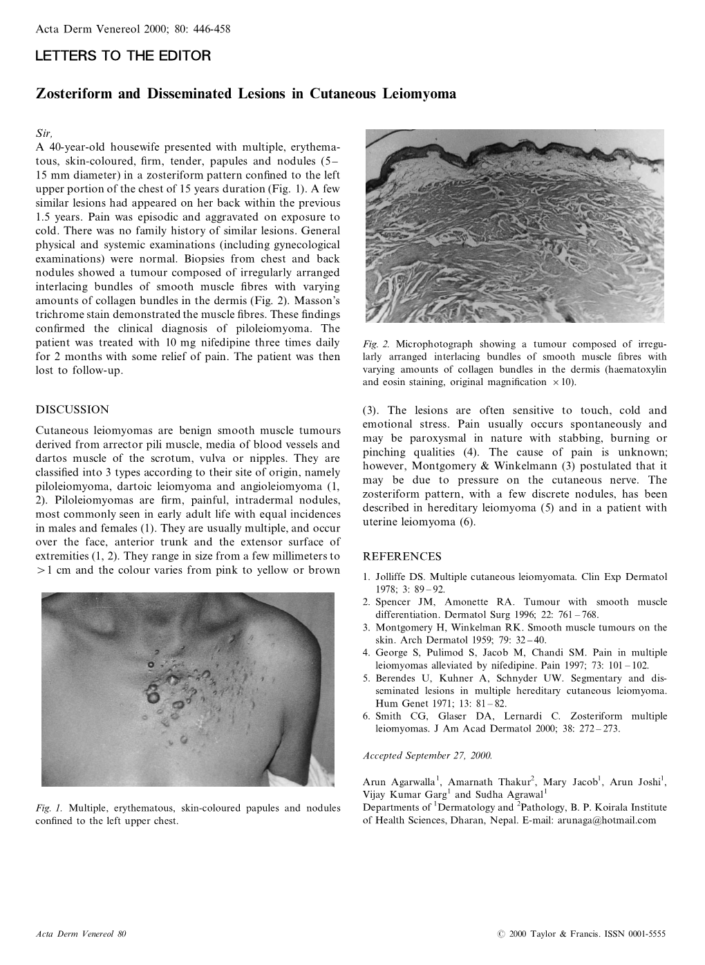 Zosteriform and Disseminated Lesions in Cutaneous Leiomyoma
