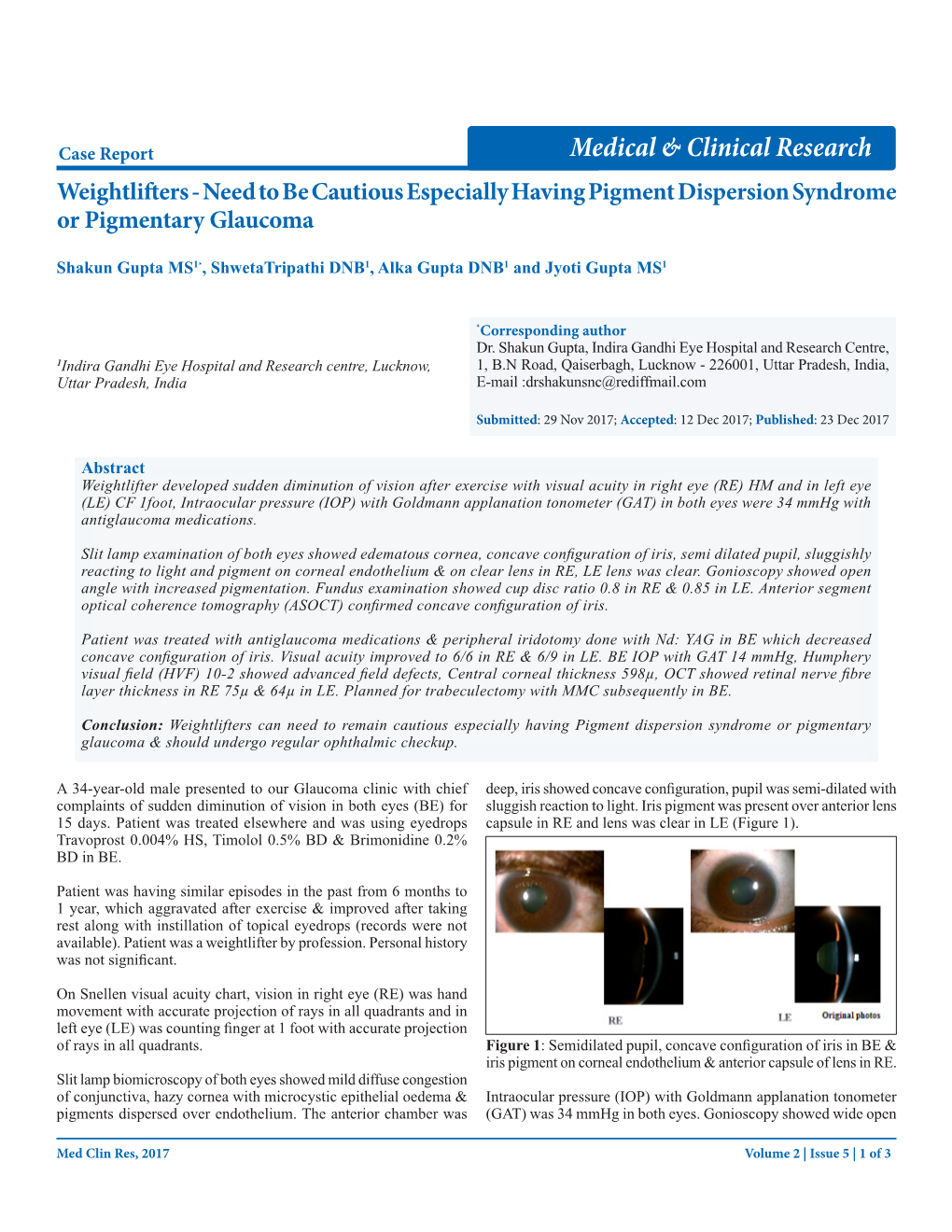 Need to Be Cautious Especially Having Pigment Dispersion Syndrome Or Pigmentary Glaucoma