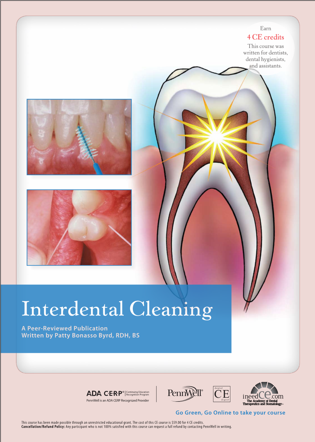Interdental Cleaning a Peer-Reviewed Publication Written by Patty Bonasso Byrd, RDH, BS