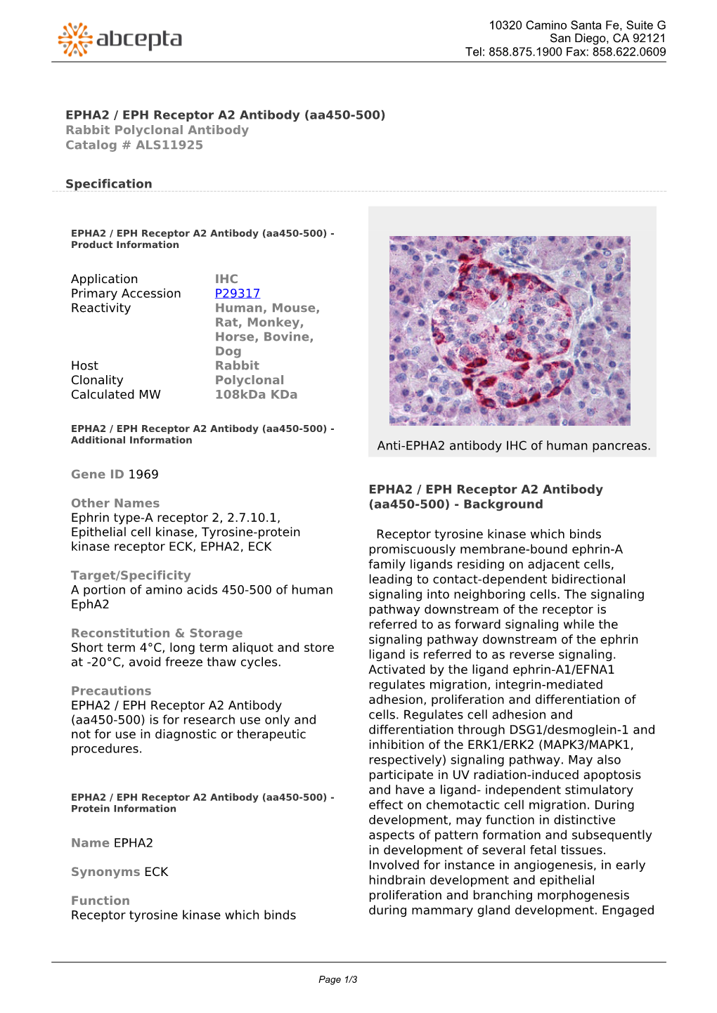 EPHA2 / EPH Receptor A2 Antibody (Aa450-500) Rabbit Polyclonal Antibody Catalog # ALS11925