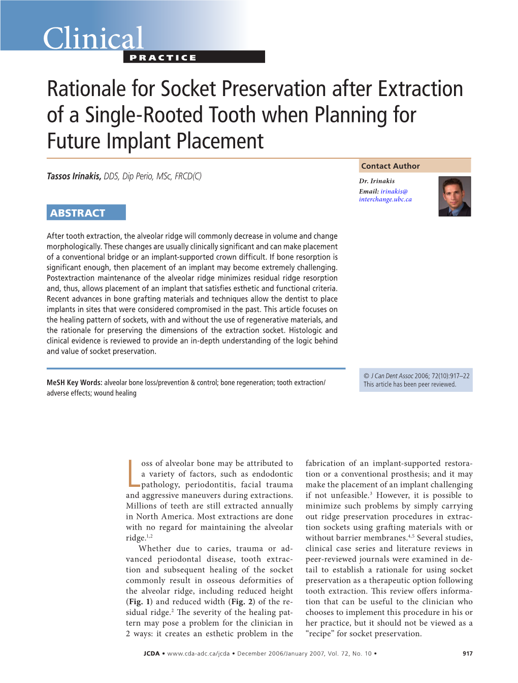 Rationale for Socket Preservation After Extraction of a Single-Rooted Tooth When Planning for Future Implant Placement