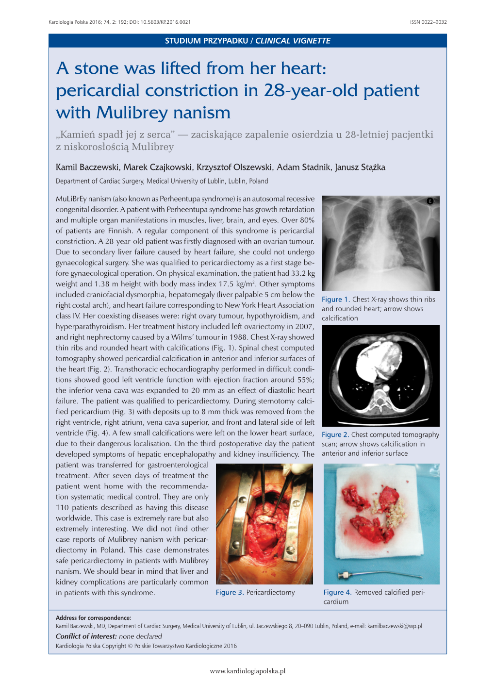 Pericardial Constriction in 28-Year-Old Patient with Mulibrey Nanism