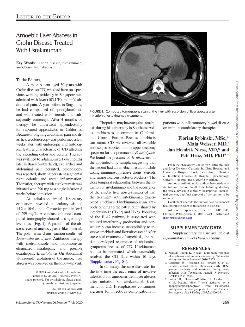 Amoebic Liver Abscess in Crohn Disease Treated with Ustekinumab