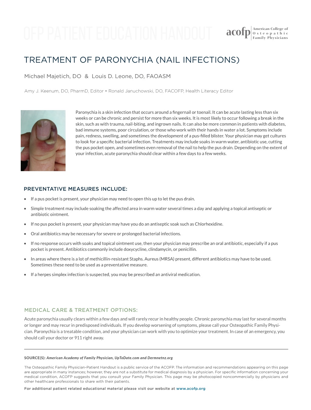 Paronychia (Nail Infections)