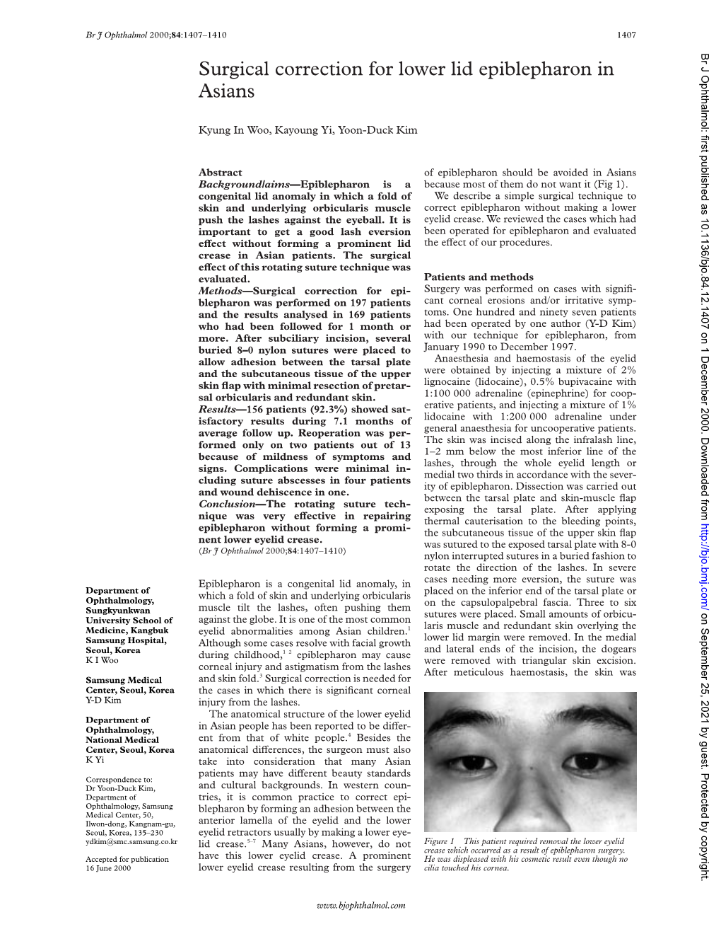 Surgical Correction for Lower Lid Epiblepharon in Asians