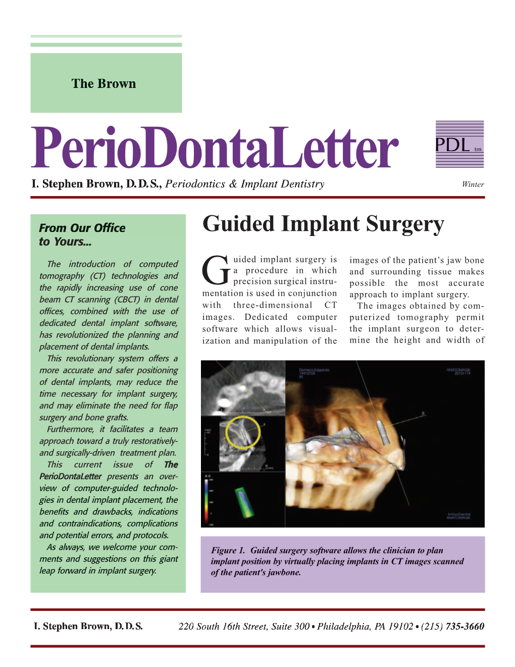 Guided Implant Surgery Drill Were Placed “Virtually” in the Kit