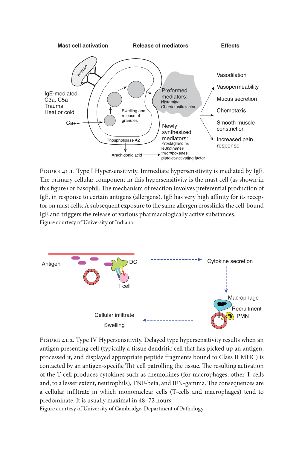 Figure . . Type I Hypersensitivity. Immediate Hypersensitivity Is