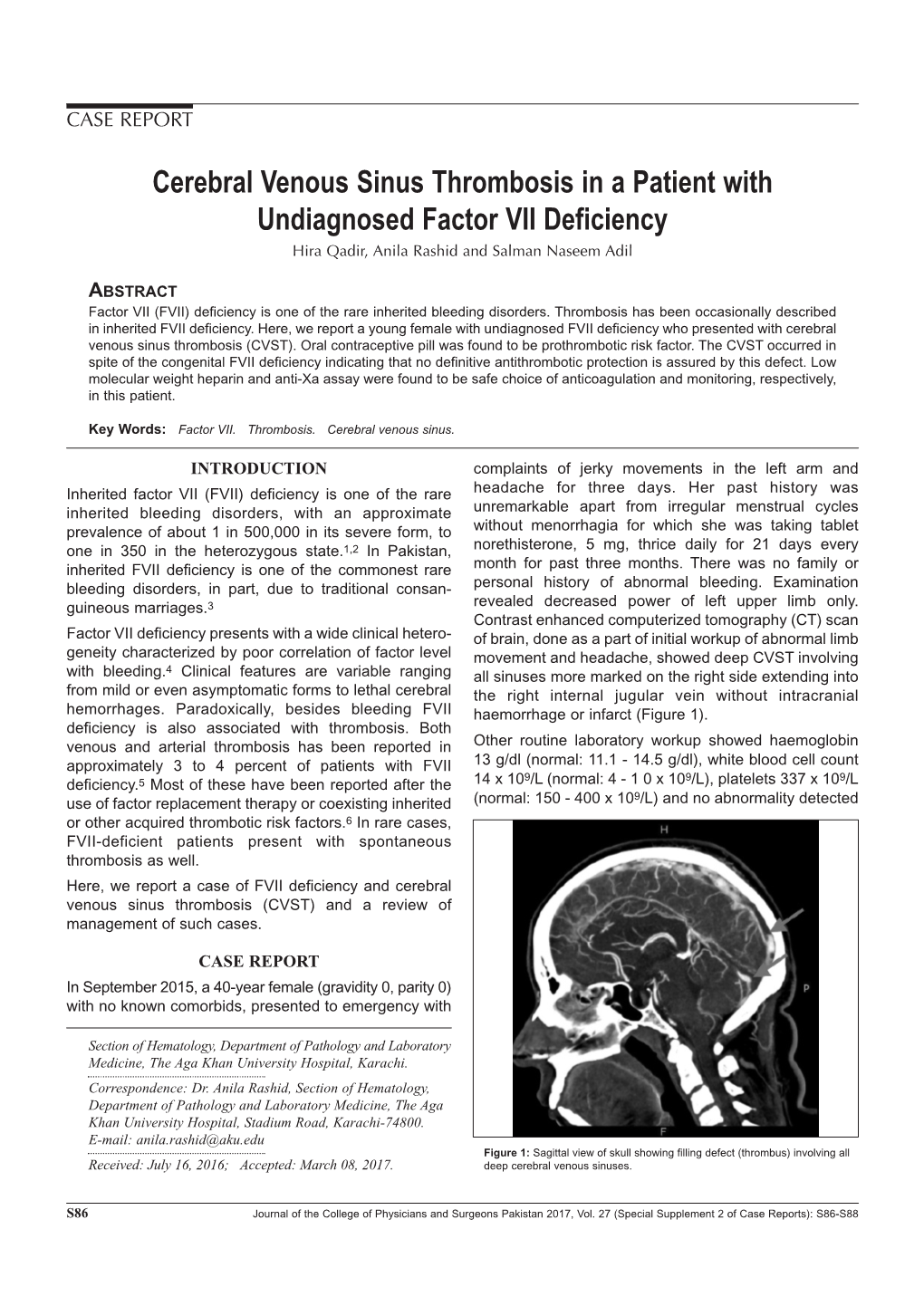 Cerebral Venous Sinus Thrombosis in a Patient with Undiagnosed Factor VII Deficiency Hira Qadir, Anila Rashid and Salman Naseem Adil