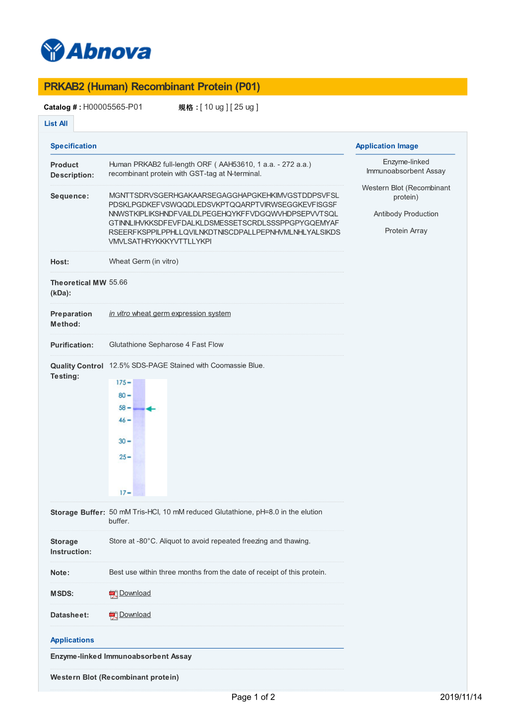 PRKAB2 (Human) Recombinant Protein (P01)