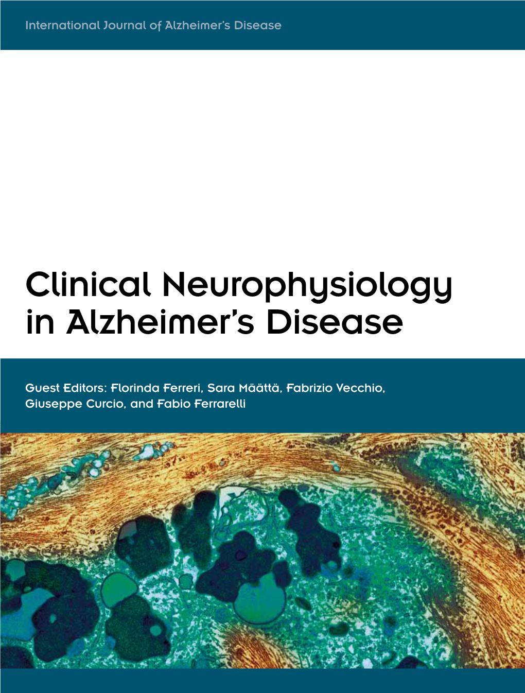 Clinical Neurophysiology in Alzheimer's Disease