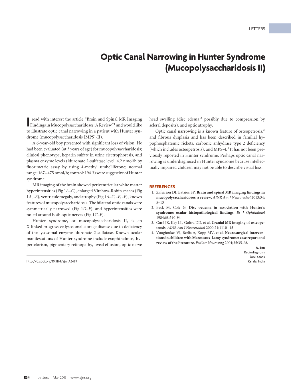 Optic Canal Narrowing in Hunter Syndrome (Mucopolysaccharidosis II)