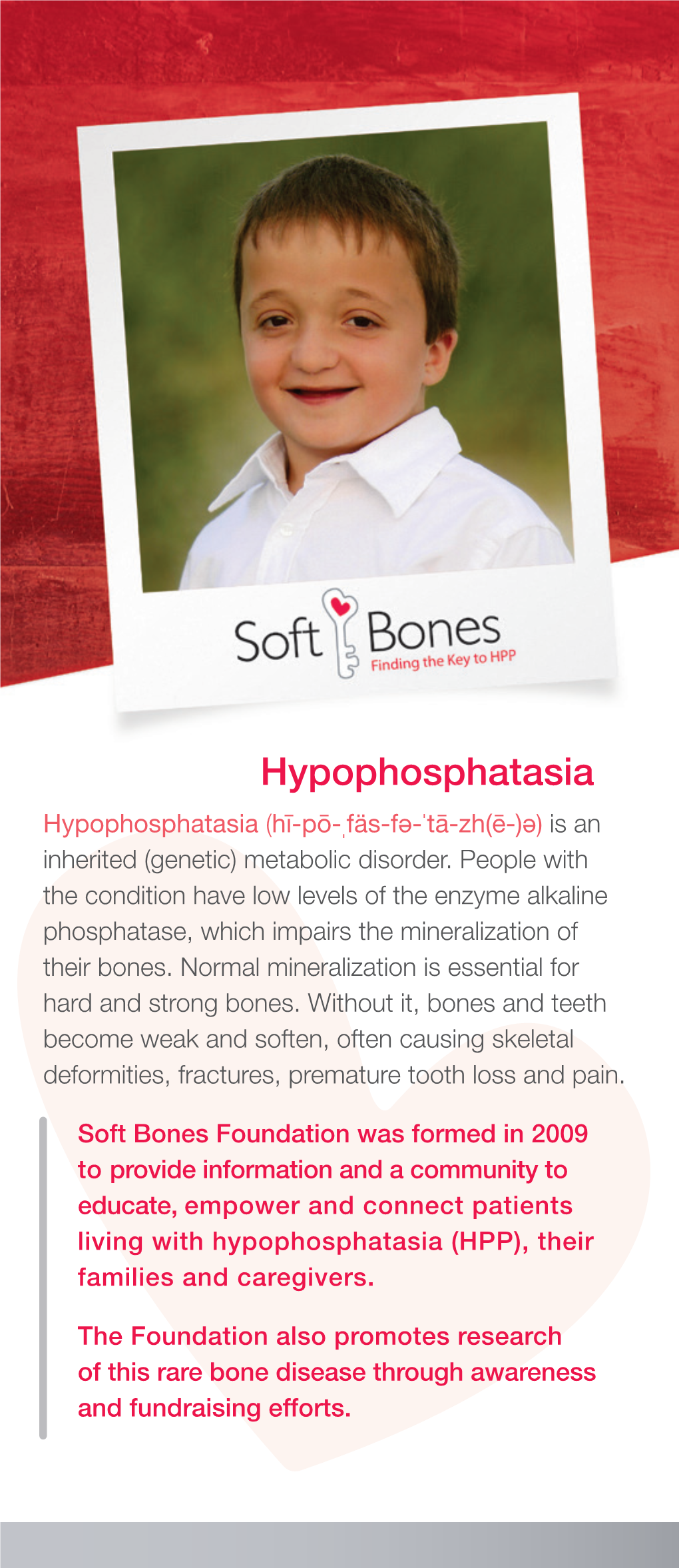 Hypophosphatasia