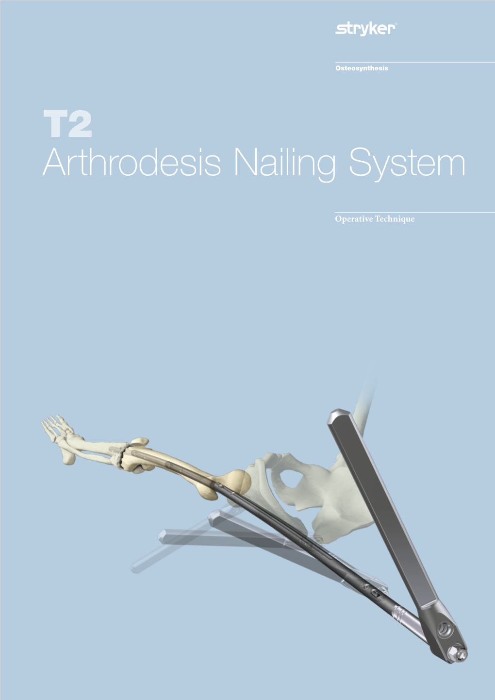 T2 Arthrodesis Nailing System