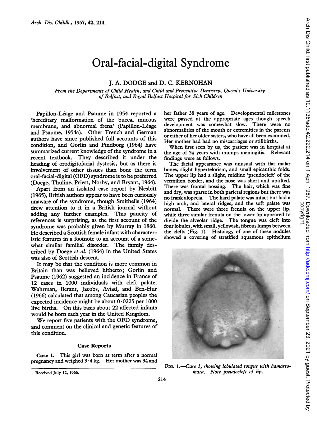 Oral-Facial-Digital Syndrome