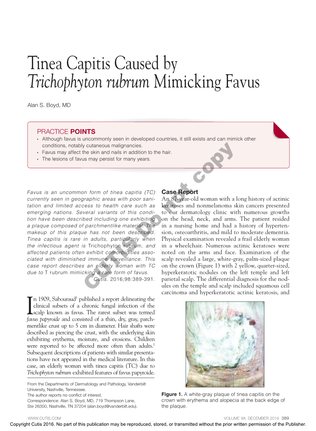 Tinea Capitis Caused by Trichophyton Rubrum Mimicking Favus