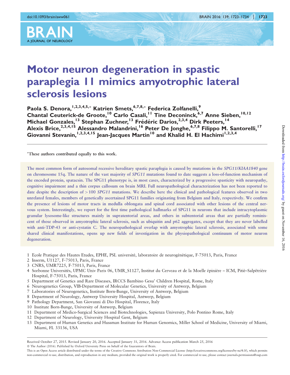Motor Neuron Degeneration in Spastic Paraplegia 11 Mimics Amyotrophic Lateral Sclerosis Lesions