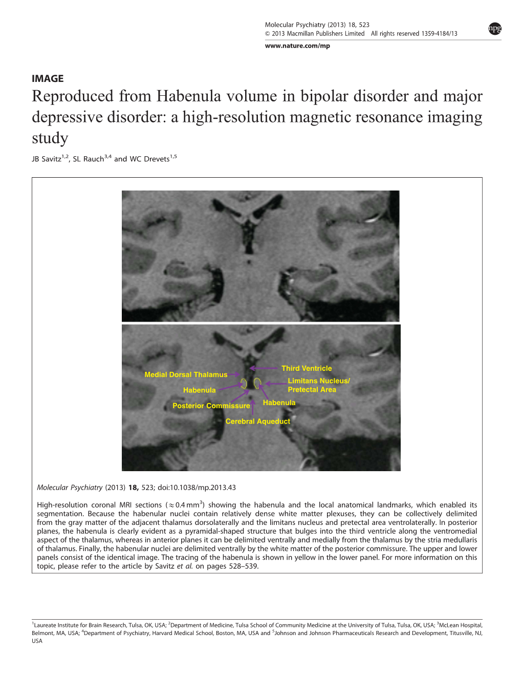 Reproduced from Habenula Volume in Bipolar Disorder and Major Depressive Disorder: a High-Resolution Magnetic Resonance Imaging Study