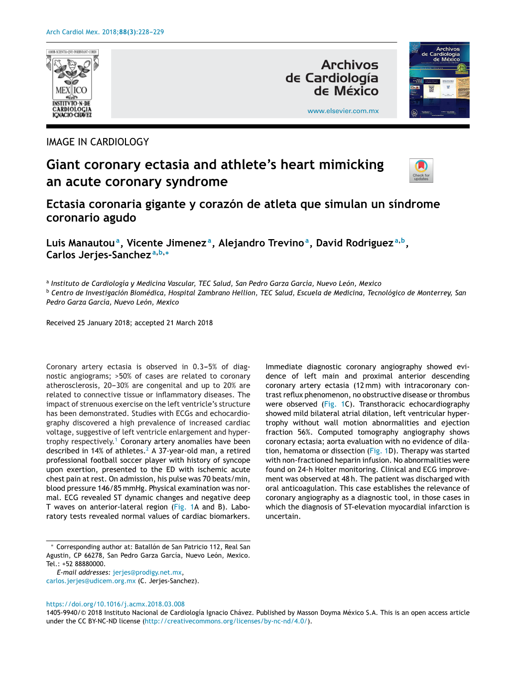 Giant Coronary Ectasia and Athlete's Heart Mimicking an Acute Coronary