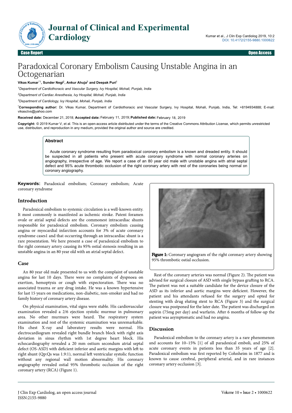 Paradoxical Coronary Embolism Causing Unstable Angina in An
