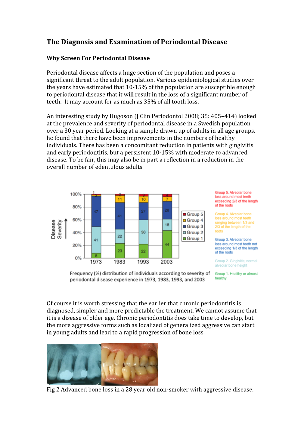 The Diagnosis and Examination of Periodontal Disease