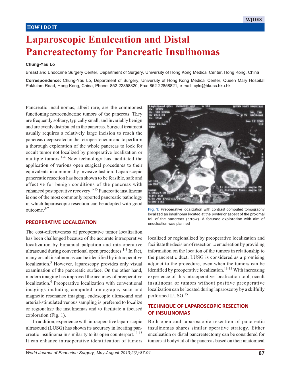 Laparoscopic Enulceation and Distal Pancreatectomy for Pancreatic Insulinomas Laparoscopic Enulceation and Distal Pancreatectomy for Pancreatic Insulinomas