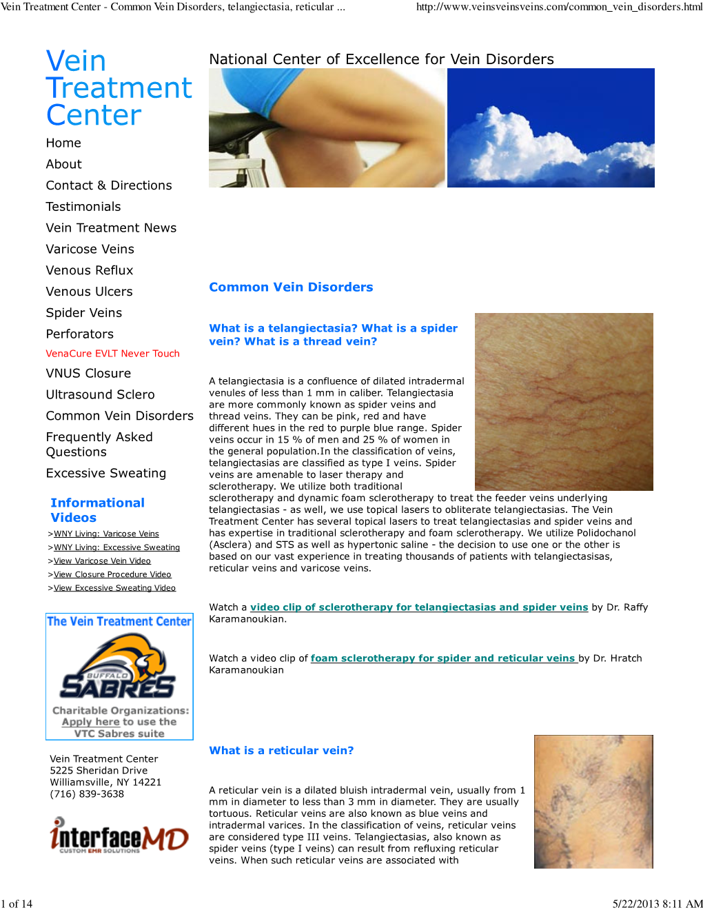 Vein Treatment Center - Common Vein Disorders, Telangiectasia, Reticular