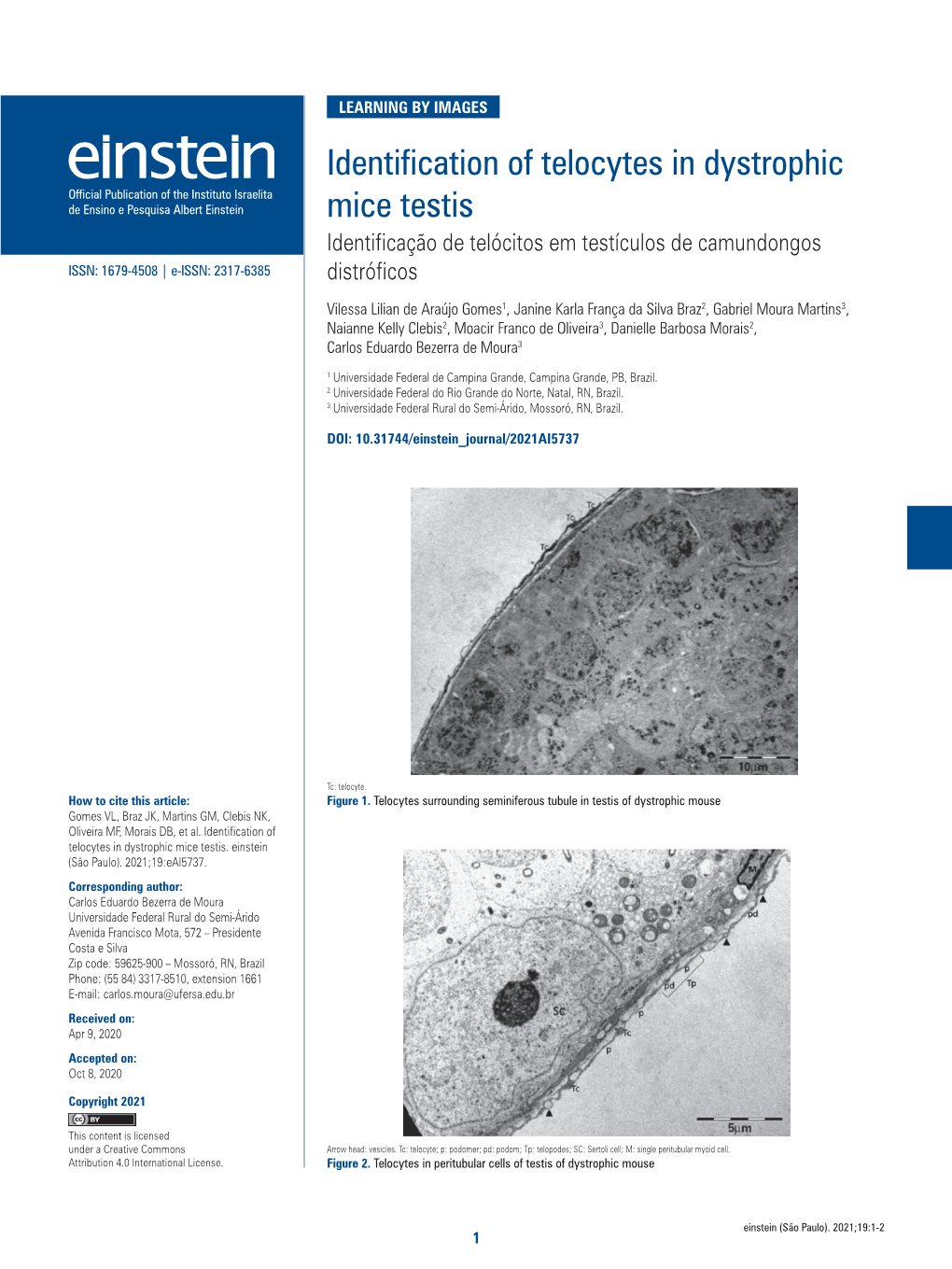 Identification of Telocytes in Dystrophic Mice Testis
